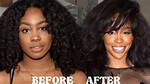 A Comprehensive Guide for Sza Before Surgery