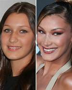 Bella Hadid: a Journey Through Transformation - Before and After