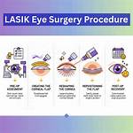Can I Drive Home After Lasik?