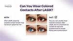 Can I Wear Contact Lenses After Lasik?