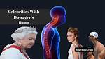 Celebrities with Dowager's Hump