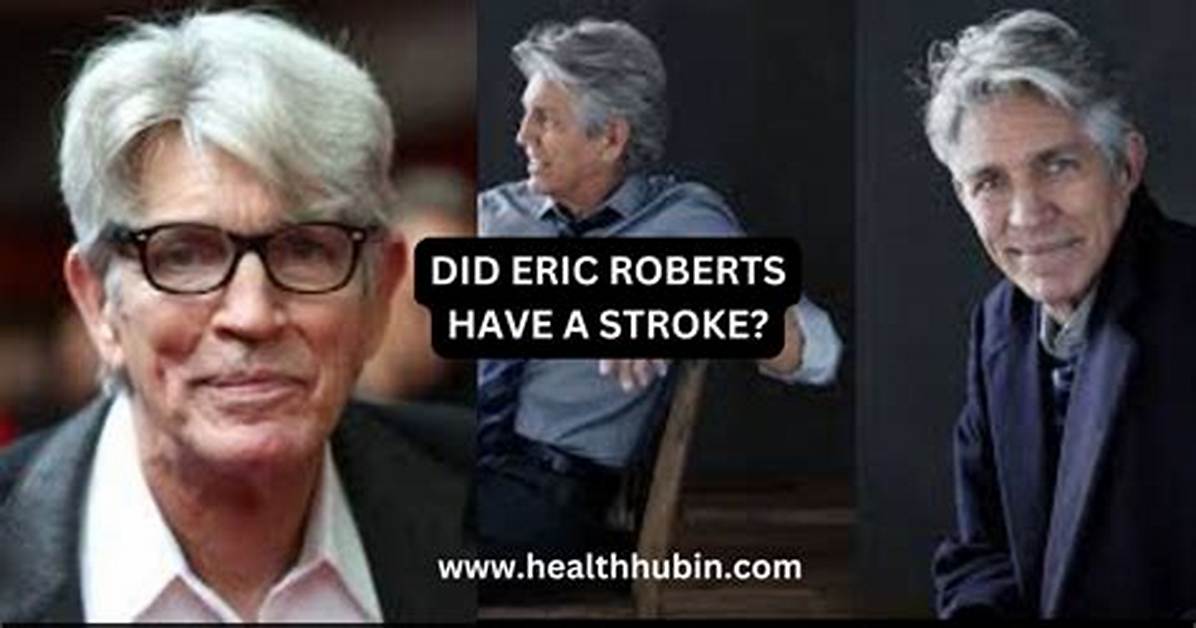 Did Eric Roberts Suffer a Stroke?