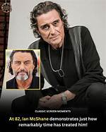 Does Ian Mcshane Have a Glass Eye? Actor Eye Related Injury and Condition Described |