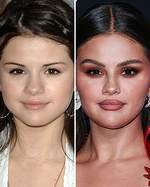 Does Selena Gomez Really Have Lice with Bf Benny Blanco?