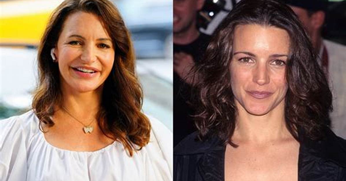 Exploring Kristen Davis' Plastic Surgery Journey