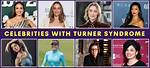 Famous Figures with Turner Syndrome
