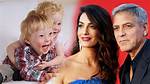 George Clooney's Child with Down Syndrome