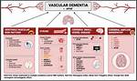 Hereditary Vascular Dementia Linked to Notch 3 Mutations: Cadasil in British Families - ePrints