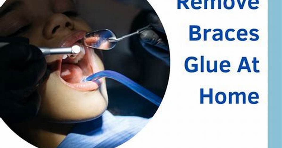 How to Remove Braces Glue