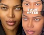 Jessica White Plastic Surgery Before and After