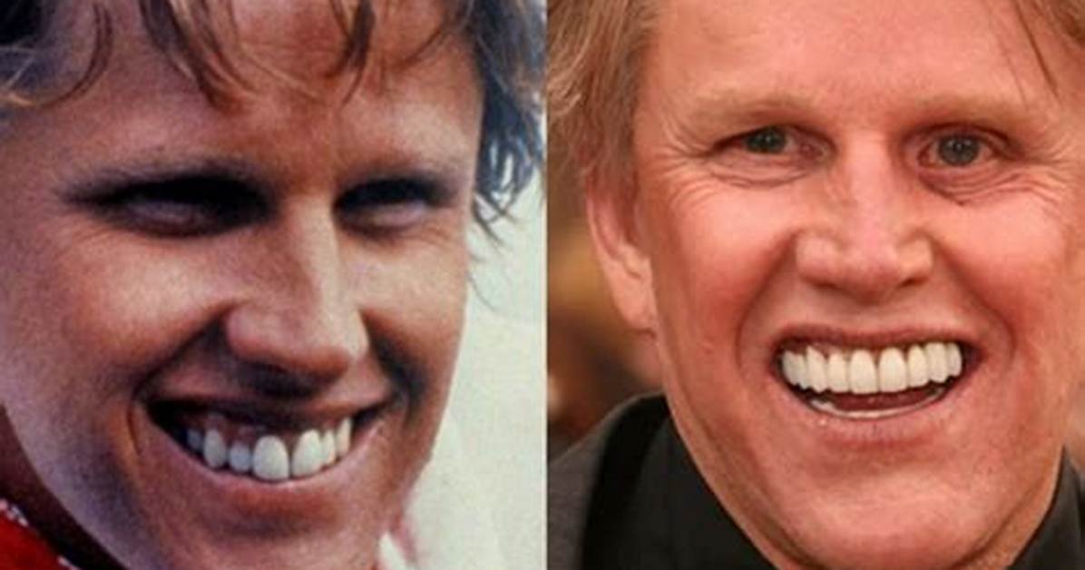 Kyle from the Challenge's Teeth Before and After Revealed ·