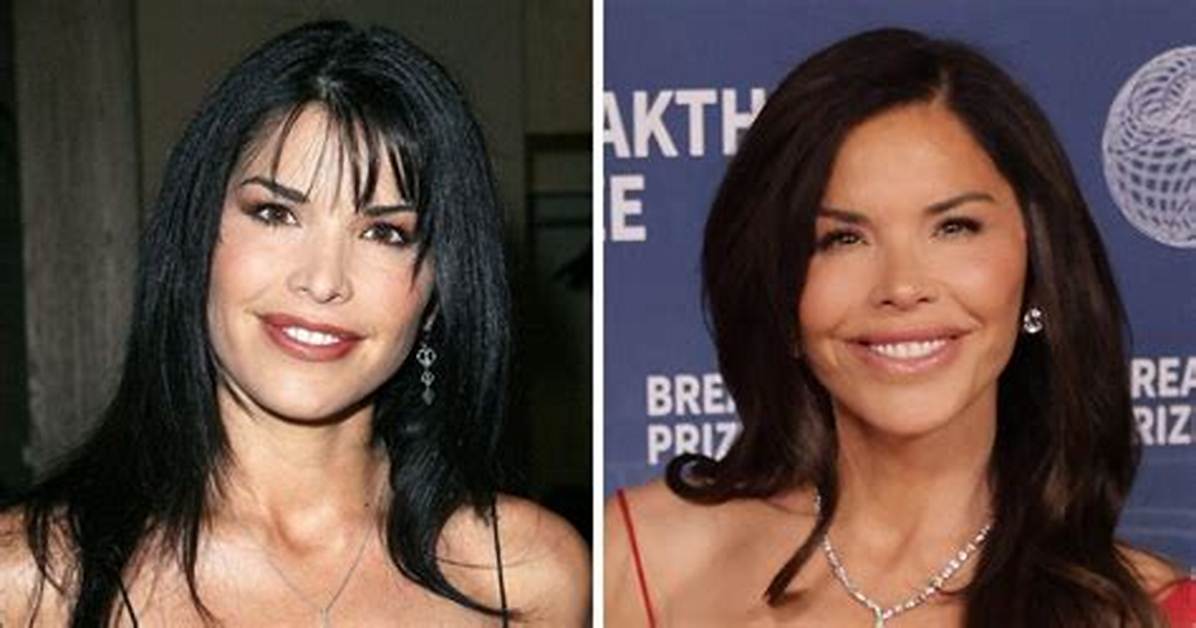 Lauren Sanchez Before Surgery – Did She Underwent Plastic Surgery?