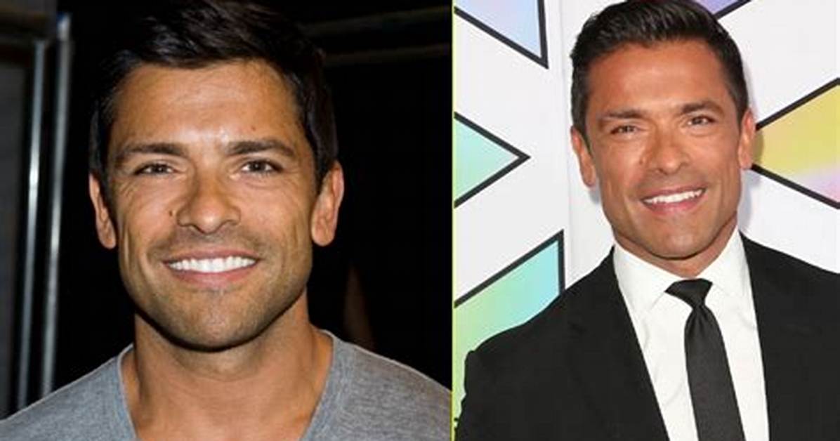 Mark Consuelos' Plastic Surgery Journey