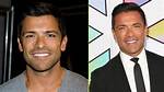 Mark Consuelos' Plastic Surgery Journey