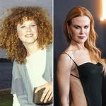 Nicole Kidman's Plastic Surgery Transformation: Before and After