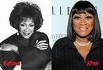 Patti Labelle's Plastic Surgery: Before and After