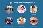 Pediatric Astigmatism: Causes, Signs and Prognosis