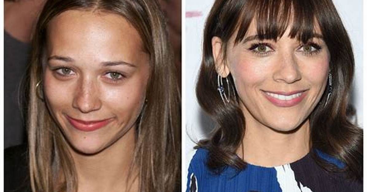 Rashida Jones Plastic Surgery Before and After