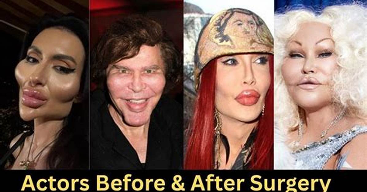 Shows off Recent Surgery Hollywood Life