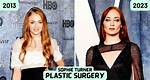 Sophie Turner Plastic Surgery: Sophie's Clear Admission or Straight Denial?