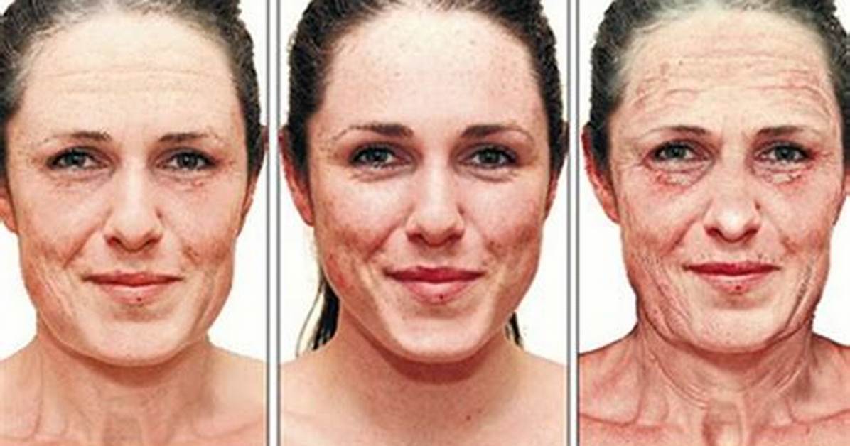 Tanning Bed Before and After 1 Week