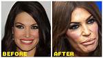 Transformations and Revelations: Kimberly Guilfoyle Before Surgery