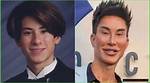 Transformations: the Story of Justin Jedlica Before Surgery