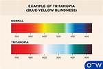 Tritanopia: Blue-Yellow Color Blindness