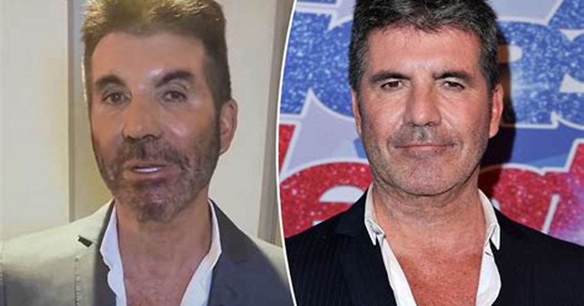 Uncover the Ailment Affecting Simon Cowell's Son: a Comprehensive Guide