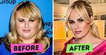 Uncovering the Secrets Before Surgery