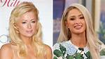 Unmasking the Truth: Did Paris Hilton Undergo Rhinoplasty?