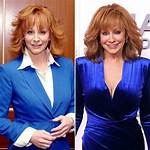 Unveiling the Reba Mcentire Plastic Surgery Saga: Surprising Truths Revealed
