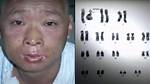 Unveiling the Secrets of Hisachi Ouchi Skin