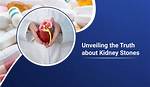 Unveiling the Truth About Kidney Surgery Scars: a Comprehensive Guide