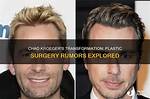 Unveiling the Truth: Chad Kroeger's Plastic Surgery Journey
