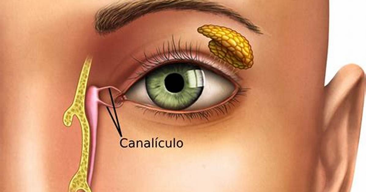 What Is Canaliculitis?